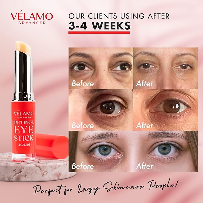 VELAMO ADVANCED Retinol Eye Stick: Retinol Under Eye Cream for Dark Circles and Puffiness with 1% Bakuchiol - Anti Aging Balm Stick Reduces Fine Lines Wrinkles Under Eye Bags in 4-8 Weeks - 2 Packs
