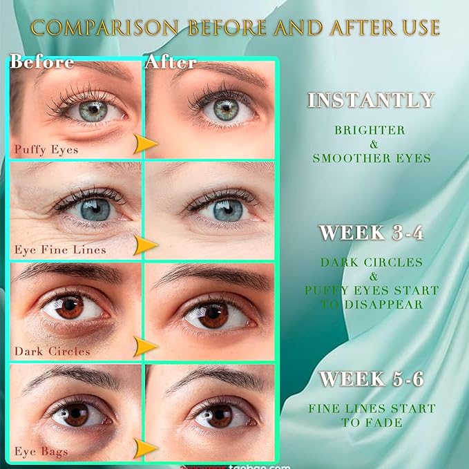 Green Seaweed Eye Mask– 60 Pcs - Gold Under Eye Mask Retinol & Collagen - Puffy Eyes and Dark Circles Treatments – Look Younger and Reduce Wrinkles and Fine Lines Undereye, Improve and Firm eye