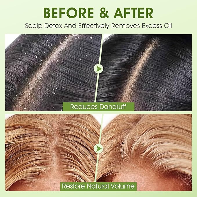 Apple Cider Scalp Scrub, 2-in-1 AHA & BHA Scalp Exfoliator Shampoo, Detox Treatment with Sea Salt, Clarify and Remove Build Up with Silicone Scalp Massager, 10.6oz/300g