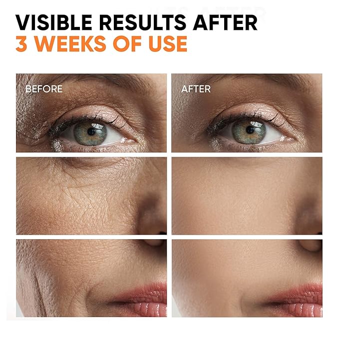 Vitamin C Serum for Face 20% Hyaluronic Acid, Niacinamide, Vitamin E, Collagen Peptides - Skin Brightening Solution for Wrinkles, Dark Spots, Fine Lines - Anti Aging Stem Cell Serum for Face, 1 oz