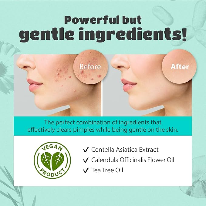 lattcare Blemish Spot Care Patches | Hydrocolloid Acne Patches | Large Spot Cover Treatment for Blemishes and Zit | Vegan, Cruelty Free Patches | Large , Long Two Sizes 39mm & 27mm (12 Count)