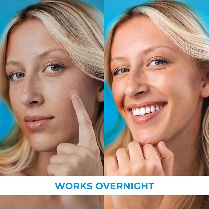 PatchRx Pimple Patches for Face (500 Patches), Hydrocolloid Acne Patches with Tea Tree Oil, Pimple Patch Pimple Stickers - Hydrocolloid Patch Acne Dots - Acne Pimple Patches For Face - Zit Patches