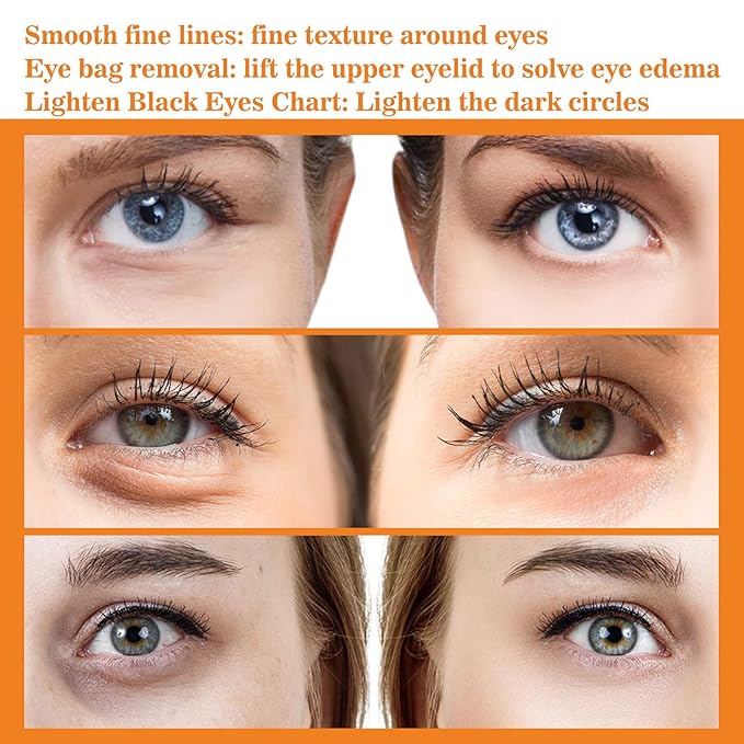 Turmeric + Vitamin C Booster Eye Cream, Brightening and Hydrating Eye Cream, Dark Circle Relief, Elasticity Treatment, Gentle Anti-Aging & Anti-Wrinkle Care