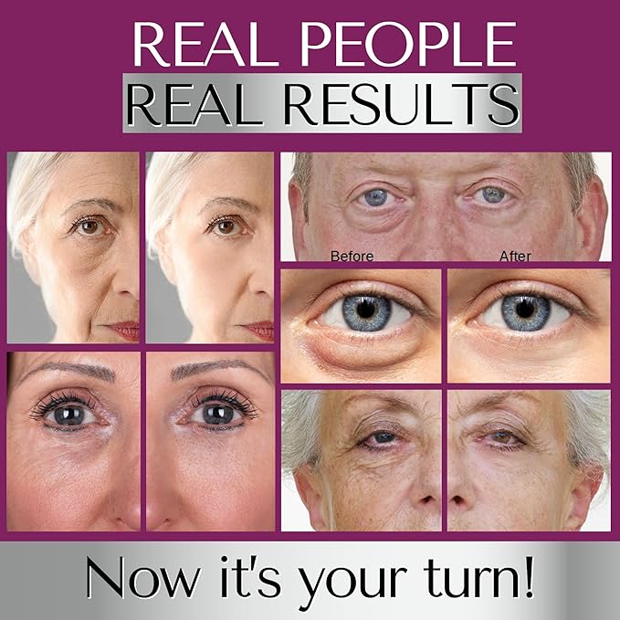 DERMAWORKS Immaculift Instant Tightener – Anti-Aging Cream for Dark Circles, Puffiness & Under-Eye Bags – Lifting & Firming Formula for Wrinkle Reduction – Fast-Absorbing Treatment for Men & Women