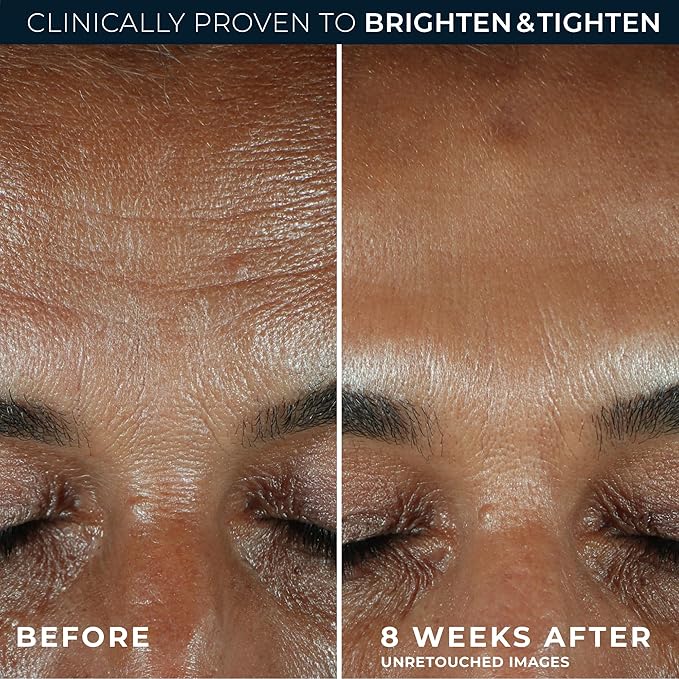 RoC Multi Correxion Revive + Glow 10% Active Vitamin C Serum for Face, Daily Anti-Aging Wrinkle and Skin Tone Skin Care Treatment, Brightening Serum, 1 Fluid Ounce