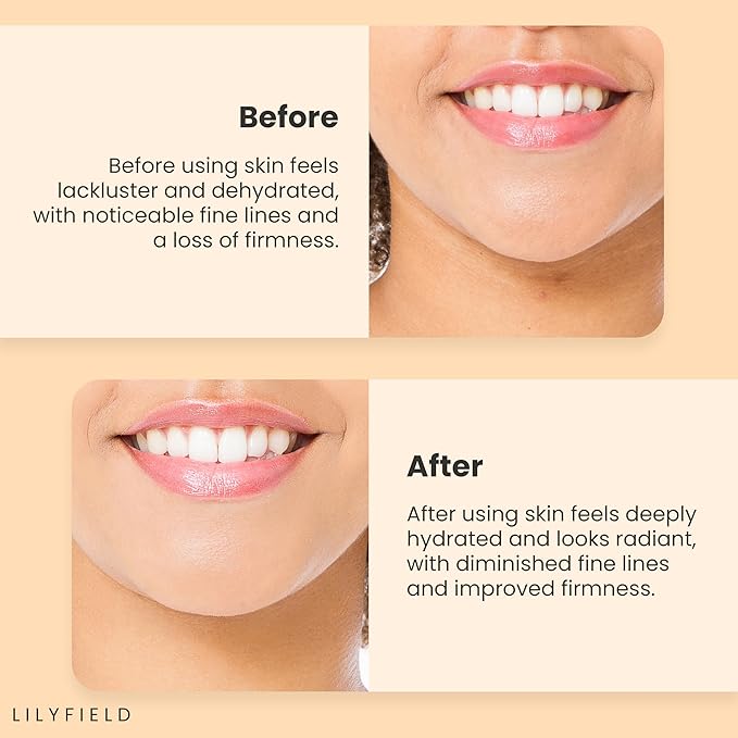 LILYFIELD Wrinkle Correcting Serum with Phyto Collagen & Vitamin C. Korean Skincare. Anti-Aging, Target Dark Spots and Fine lines,Smoothing, All Skin Types. Korean Skin care 30ml, 1 fl. oz