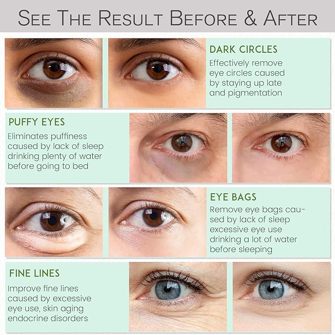Under Eye Patches for Dark Circles and Puffiness - Under Eye Masks Anti-Aging Collagen Hyaluronic Acid, Reduce Dark Circles & Wrinkles Skincare Beauty Products for Self Care (30 Pairs) 2