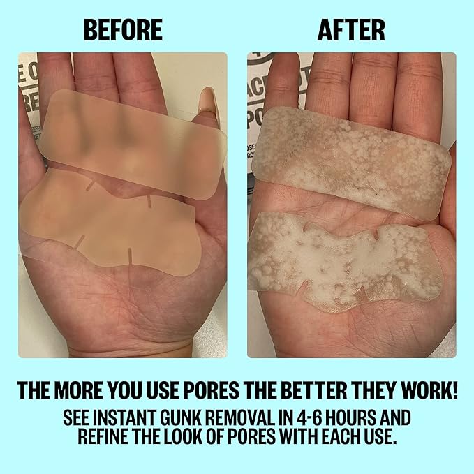PEACE OUT Skincare Pore Minimizing Strips, Hydrocolloid Pore-Refining Nose and Face Strips with Retinol & Vitamin A to Shrink Enlarged Pores and Remove Blackheads (4 pore and 4 nose strips)