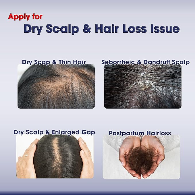 Dry Scalp Serum for Hair Growth - Improves Scalp Health to Promote Hair Grow Longer Thicker Stronger Fuller & Shinier, Hair Scalp Oils for Hair Growth Non-greasy, No Sticky Residue.