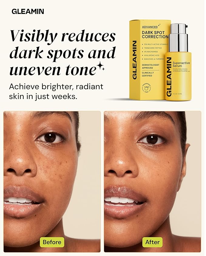 Gleamin Superactive Vitamin C Serum – 15% Vitamin C, 3% Tranexamic Acid, 4% Niacinamide & Bakuchiol – Reduces Discoloration, Uneven Tone, Brightens Skin & Smooths Texture – Fragrance-Free, 1 fl oz