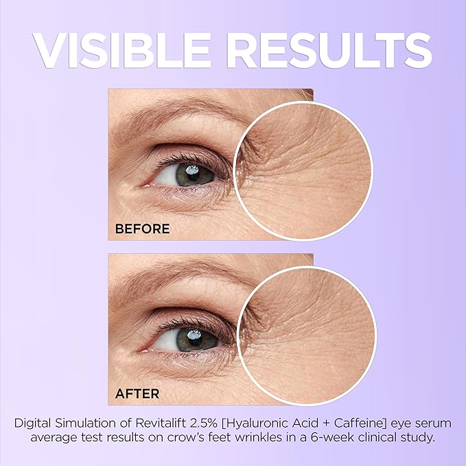 L'Oreal Paris Revitalift Hyaluronic Acid + Caffeine Hydrating Eye Serum for Dark Circles, Fragrance Free .67 fl. oz + Moisturizer Sample