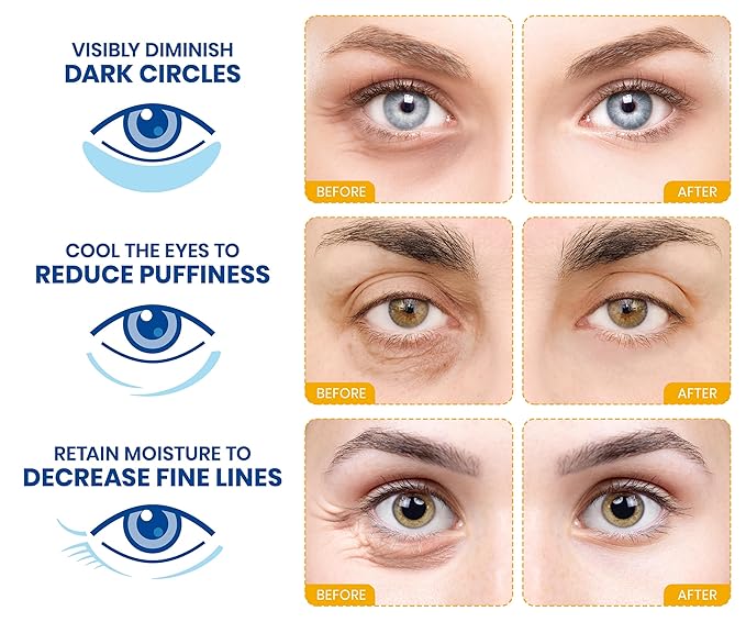 Stylia Under Eye Patches for Dark Circles and Puffy Eyes (15 Pairs) - 24k Gold Collagen Mask with Hyaluronic Acid, Eye Masks for Dark Circles and Puffiness, Gifts for Women, Valentines Day Gifts