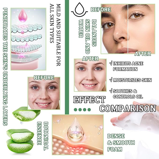 10Pcs Skin Care Kit,Skincare Gift Set with Facial Cleanser,Toner,Serum,Eye Cream, Face Cream,Exfoliating Gel,Sleeping Lip Mask & 3 Pcs Aloe Vera Mask Kit for Women