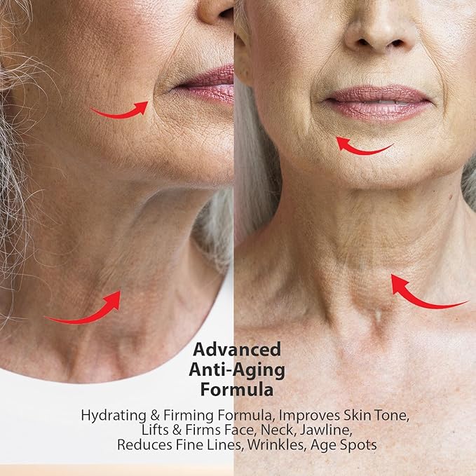 UOG Super Vitamin C Face Serum - Anti-Aging, Hydrating & Firming Formula, Lifts & Firms Face, Neck, Jawline, Reduces Dark Spots, Age Spots, Fine Lines, Wrinkles, Even Skin Tone.1 Fl Oz - Pack of 3