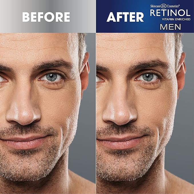 Retinol Men’s Charcoal Blackhead Remover – The Original Anti-Aging Peel-Off Cleansing Pore Strips – Unclogs Pores & Lifts Out Deep-Down Dirt, Oil & Blackheads In Just 10 Minutes