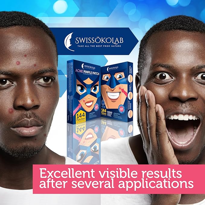 SWISSÖKOLAB Acne Patch Pimple Patch Hydrocolloid Acne Stickers Absorbing Spot Dot Acne Cover 144 Acne Dots Pimple Sticker Acne Pimple Master Patch Blemish Patches