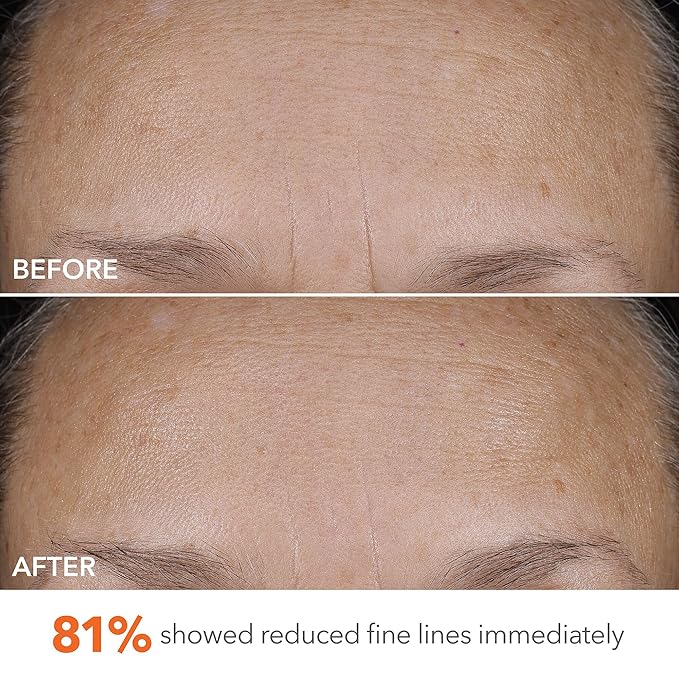 Dr Dennis Gross DermInfusions Blur + Repair Cream, Instantly Blurs Fine Lines, Smooths Skin with Satin-Matte Finish, Visibly Plumps & Firms, Reduces Redness, & Improves Skin Elasticity, 0.67 Fl Oz